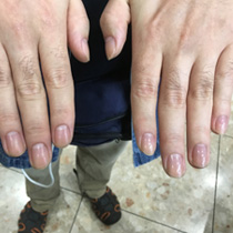 2017ネイルEXPO 受賞写真